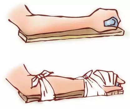 救护车还没来的那段时间,你该怎么办?