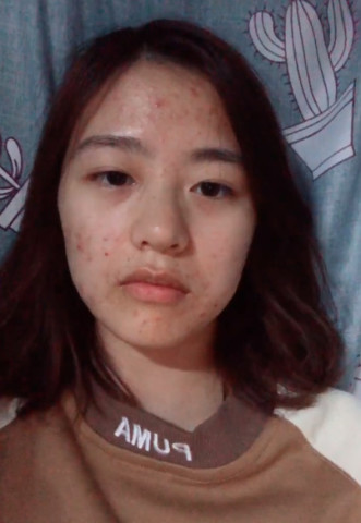 满脸青春痘的小姐姐火了,当她笑起来的一瞬间,网友:潜力股!