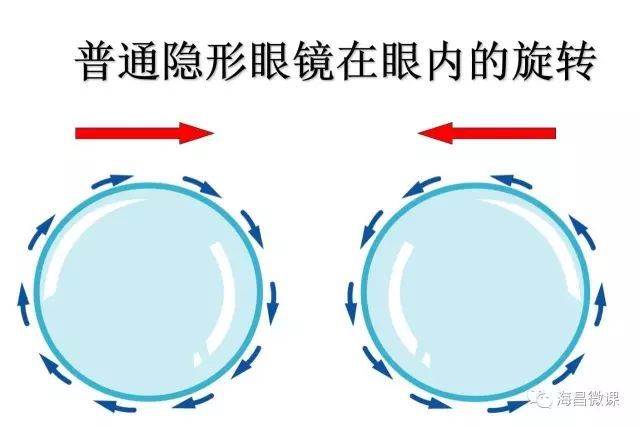 散光隐形眼镜验配技巧