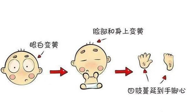 不做小黄人,对治新生儿黄疸,应多注意保暖,提早