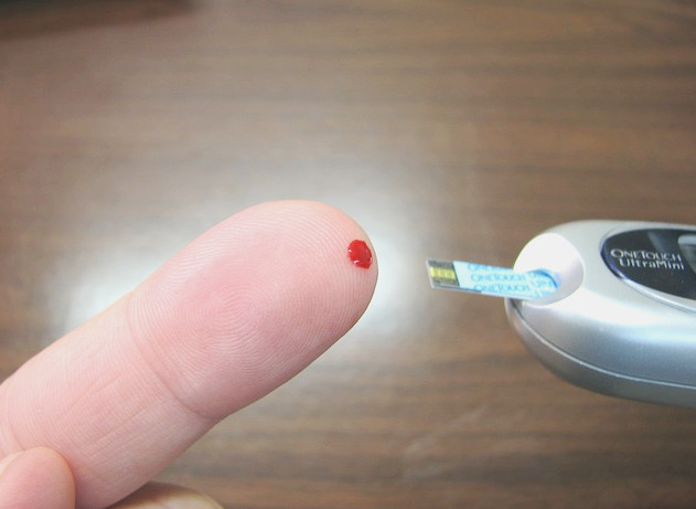 糖尿病不能只检测空腹血糖!扎手指采血前得做好5件事