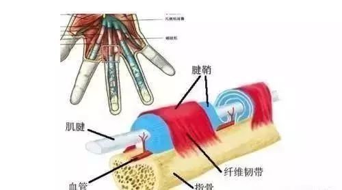 腱鞘炎病因治疗预防
