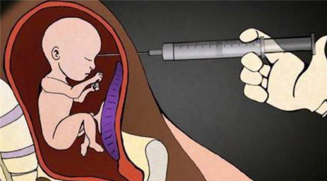 怀孕7个月胎儿被引产,宝宝出来拳头紧握,仔细