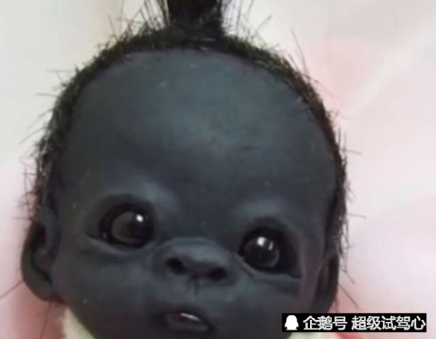 "世界最黑婴儿"3年过去了,眼睛指甲全黑,被称"圣婴"