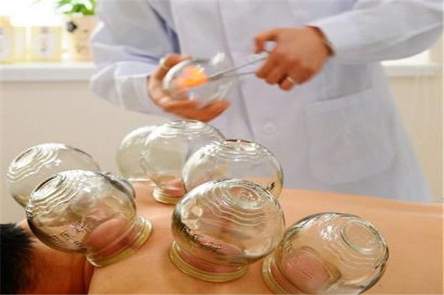 拔火罐真的能够去除体内湿气吗?别傻傻随