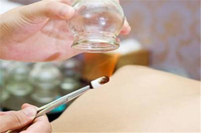 拔火罐真的能够去除体内湿气吗?别傻傻随