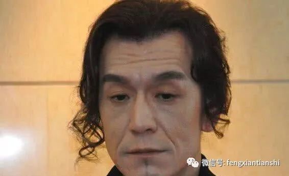 李咏生前治疗了17个月，梅奥诊所价格表曝光，费用常人承受不起