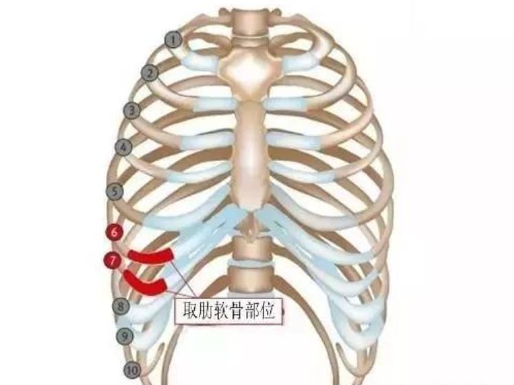 那些隆鼻时用了男朋友身上肋骨的女生怎么样了?