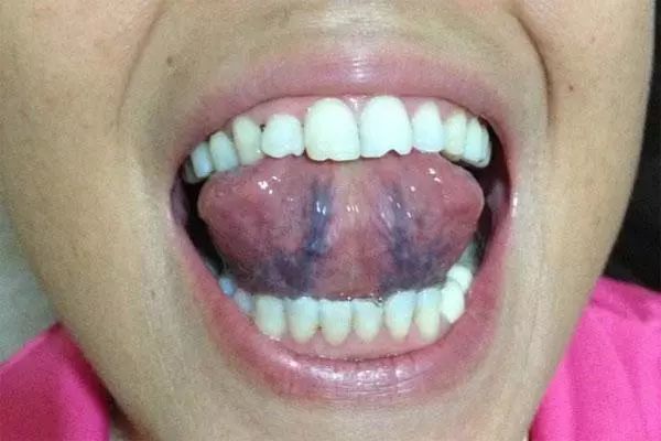 15 舌头是在嘴巴里的器官,很多人不会关注到它,往往舌头的健康就会被