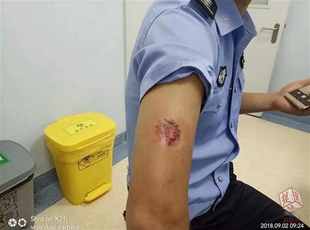 宜昌男子遇查咬民警一口 获刑6个月