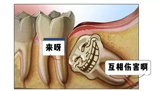 牙齿到点出现智齿就特聪明地潜伏着为了能让人类能好好吃饭牙与牙之间