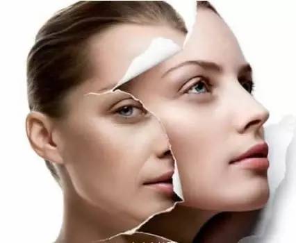 为什么要长斑?女人必看!