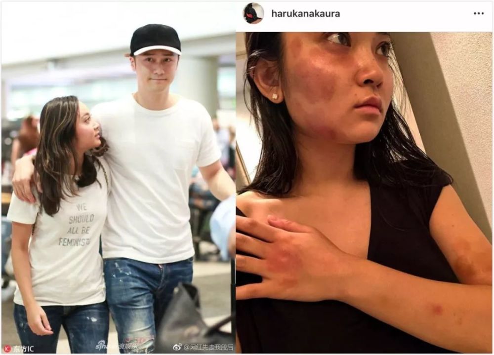 蒋劲夫承认家暴日本女友,好友晒图证女方假孕