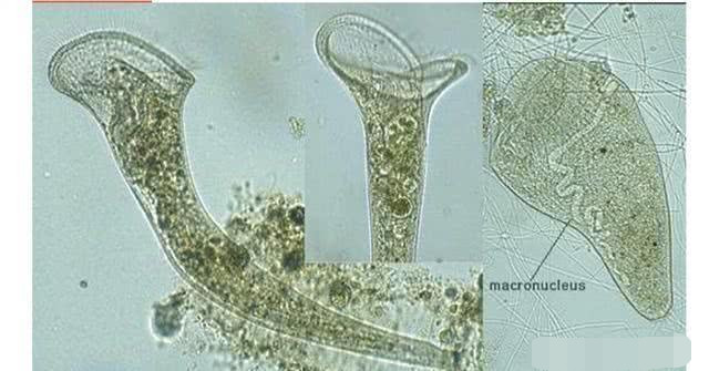 世界上最大的单细胞生物有多大?