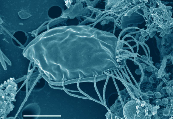 加拿大科学家发现未知真核生物 外形类似毛状南瓜种子