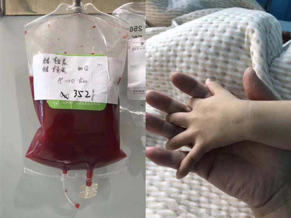 男子抽骨髓欲救3岁癌童 女儿一句话令他落泪