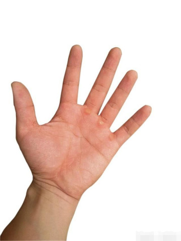 640