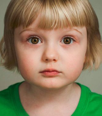 宝宝的双眼皮到几岁才能看出来?