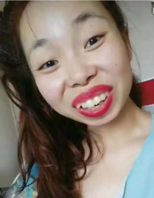 丑女嘟嘟姐回归网络,疑似整容,网友:曾经吓人如今美的