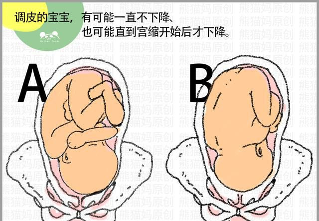 影响胎儿不入盆的5大因素长期坐姿,骨盆狭窄,腹部松软