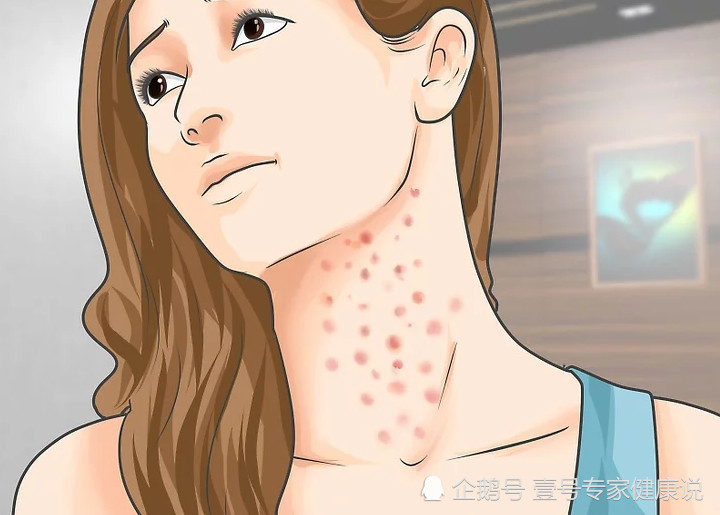 艾滋病感染信号:身上出现这7个症状,你的感冒