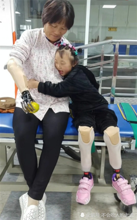 失去双脚的六岁女孩,受伤五个月重返校园,穿上假肢之后重现站立