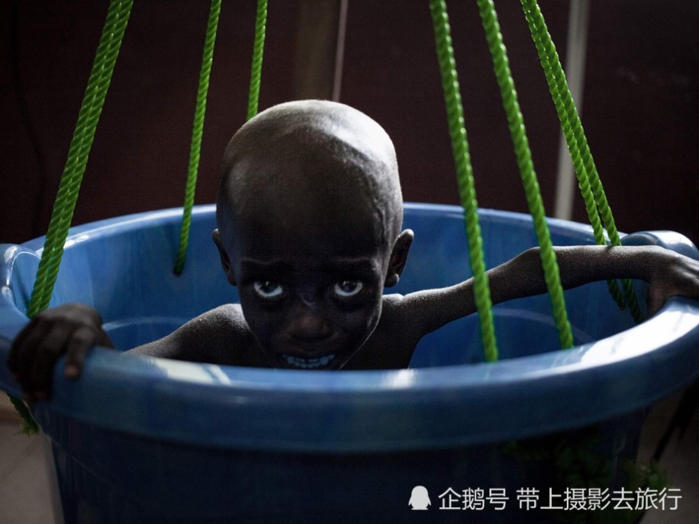 走近世界上婴儿死亡率最高的国家,儿童瘦成皮包骨生不