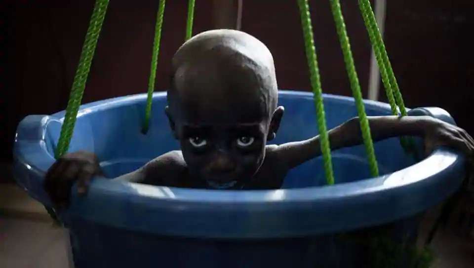 中非共和国4万儿童没饭吃,每24个孩子中就有一个活不过28天