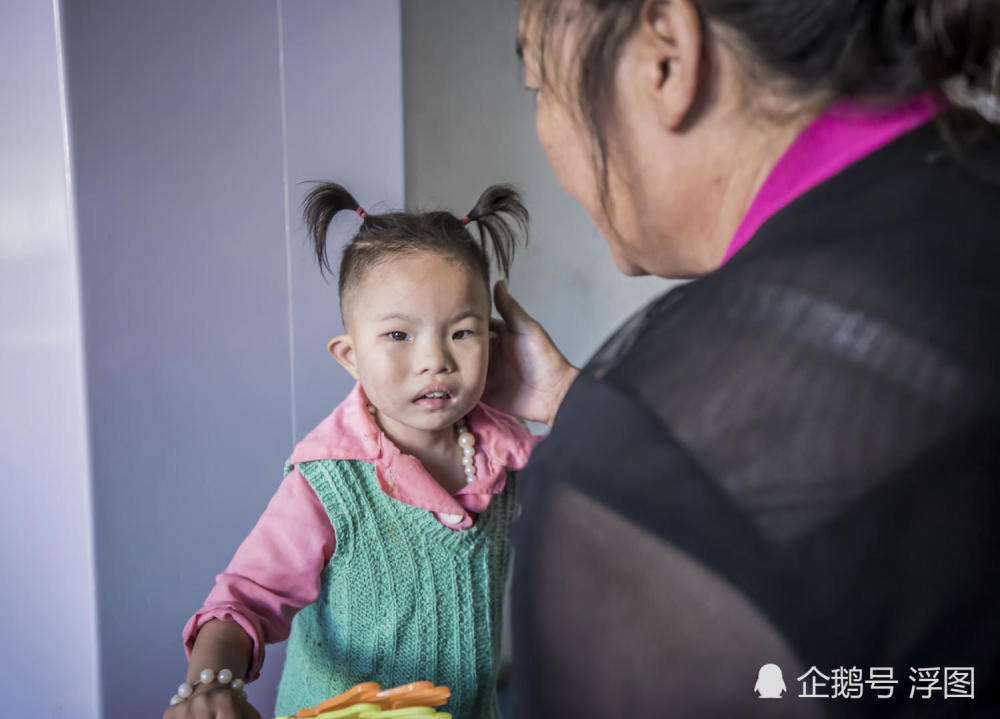 3岁女孩患病舌头僵硬吃饭困难 奶奶咀嚼后嘴对