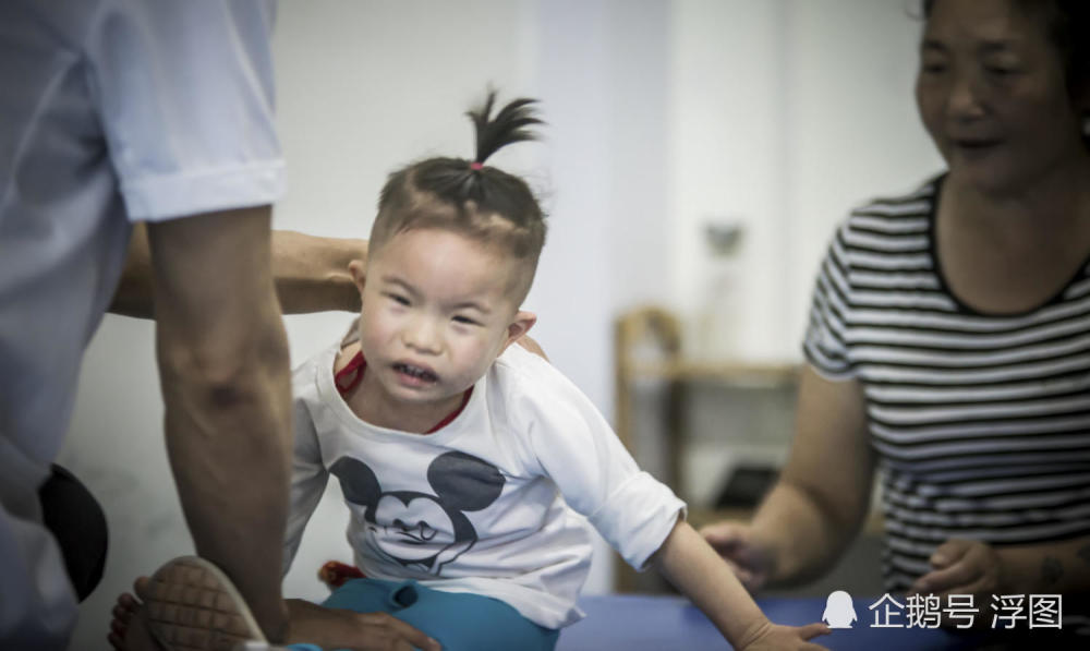 3岁女孩患病舌头僵硬吃饭困难 奶奶咀嚼后嘴对