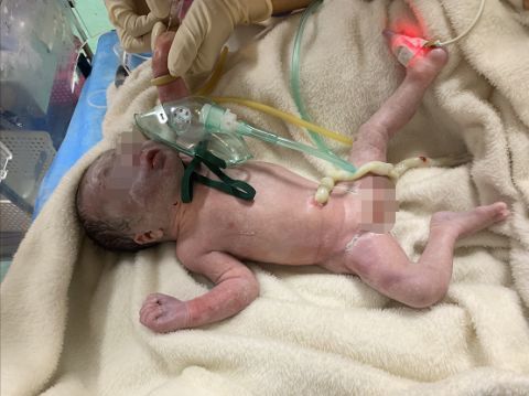 温州一男婴被遗弃鞋厂厕所 冻得浑身发青警方介入