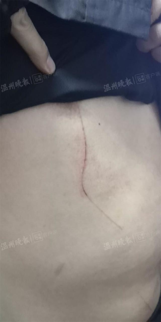 温州19岁女生救人轻生95后协警跳瓯江醉酒结婚有没有姑娘问男生图片