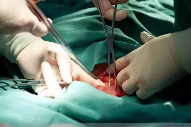 100张剖腹产过程照片,女人真的太伟大了,看哭了所有人