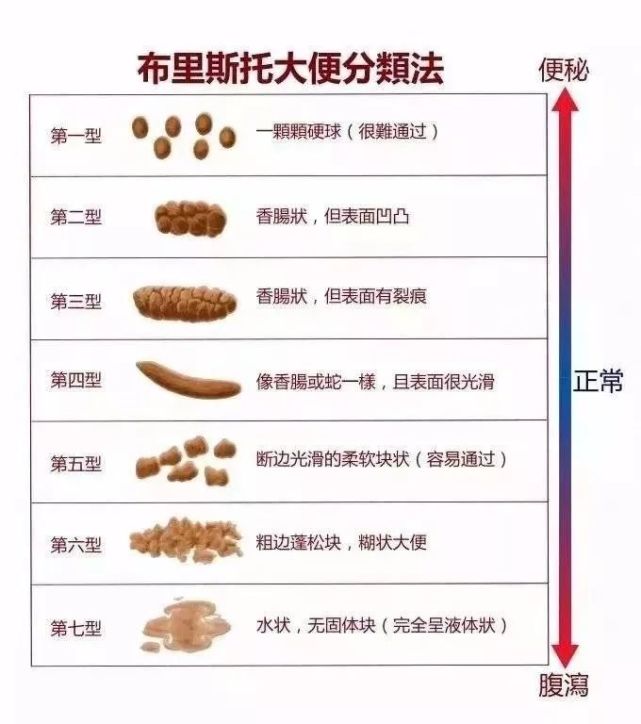 排便时,首先要留意大便的形状和质地.