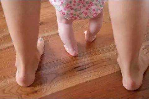 在担心宝宝是o型腿或x型腿?这些关于宝宝腿部发育知识