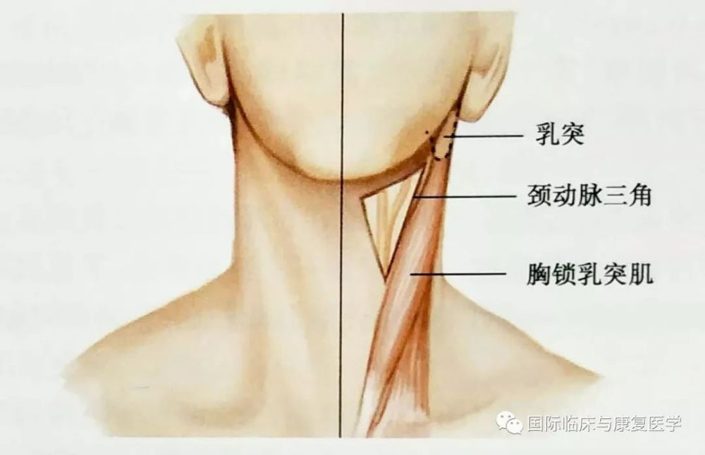 颈动脉三角解剖示意图    胸锁乳突肌(sternocleidomastoid)