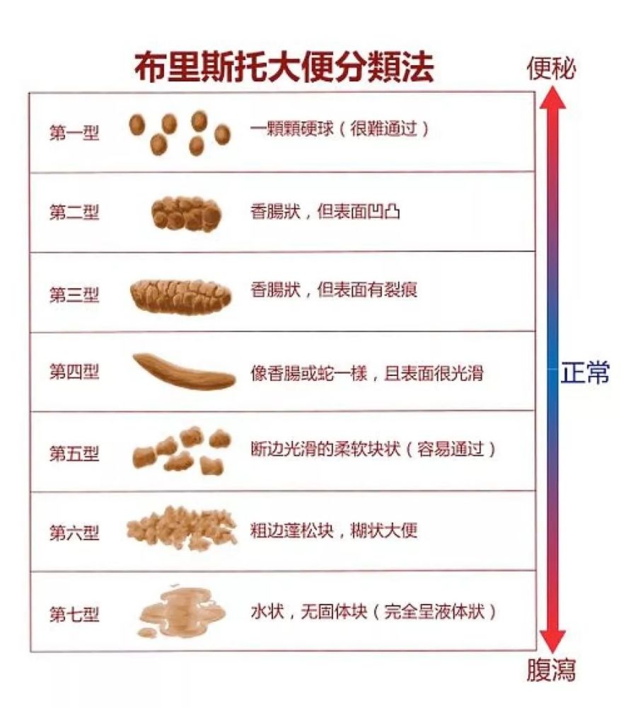 7种异常大便颜色,上完厕所别忘看一眼!
