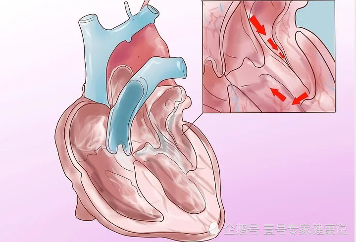 不论男女,6个症状出现,小心心脏病发作,赶紧做