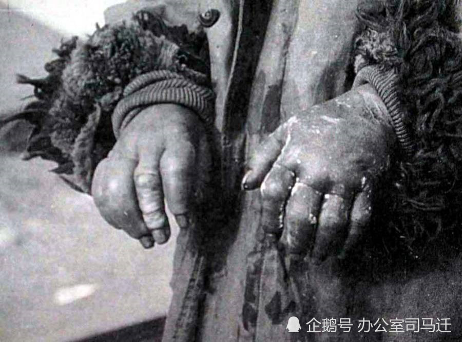 这群魔鬼真该死,这些照片记录了日本731部队在我国的