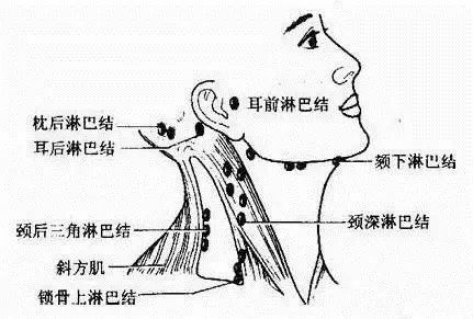 腋下淋巴结堵塞,可直接导致乳腺癌!