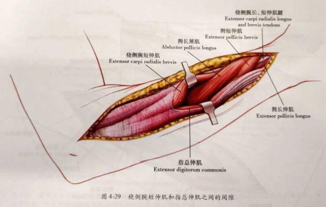 该间隙在远侧更明显,此处拇长展肌和拇短伸肌自两肌间穿出.