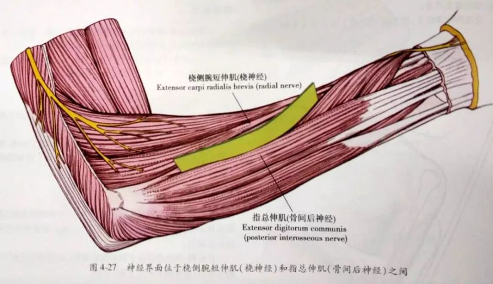 界面位于桡侧腕短伸肌(由桡神经支配)和指总伸肌(由骨间后神经支配;图