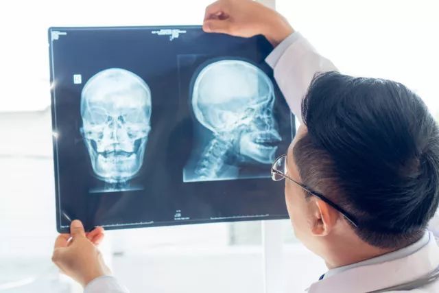 口腔ct谈"辐"色变?让亿大君还您一个真相