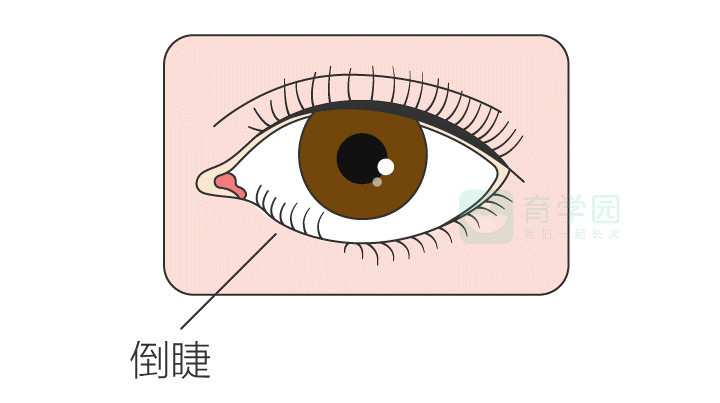 宝宝眼睛红、分泌物多、揉眼角,小心这几种问