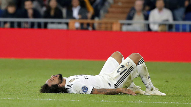 皇马2018年43人次受伤 专家:6成伤在肌肉 极不