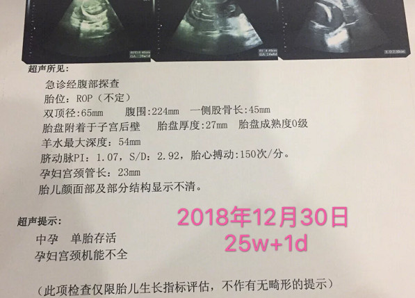 25孕周,头胎宫颈管短,住院保胎中,新年小目标是