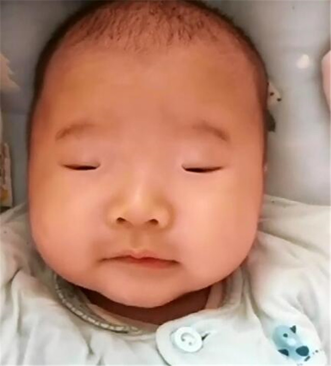 2个月宝宝还不会睁眼,妈妈担心会影响视力,听