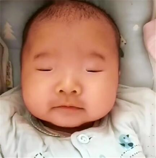 2个月宝宝还不会睁眼,妈妈担心会影响视力,听