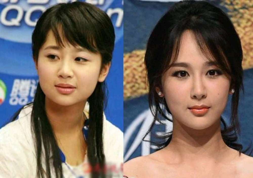 有一种"整容"叫明星出道前,张艺兴从胖子变型男,她的