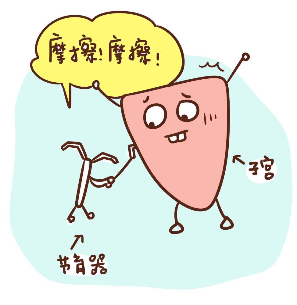 造成子宫发生无菌炎症的情况,导致胚胎无法存活,从而达到避孕的目的